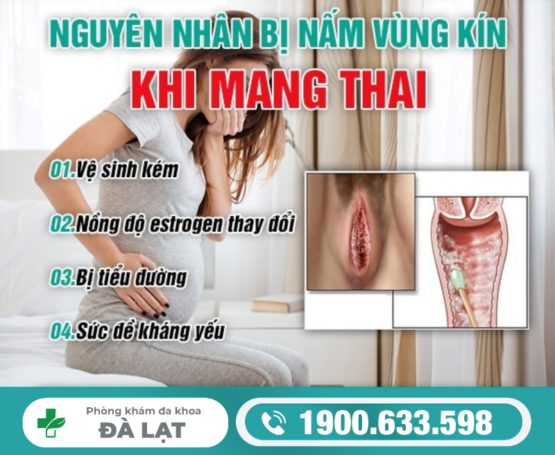 Hình ảnh minh họa